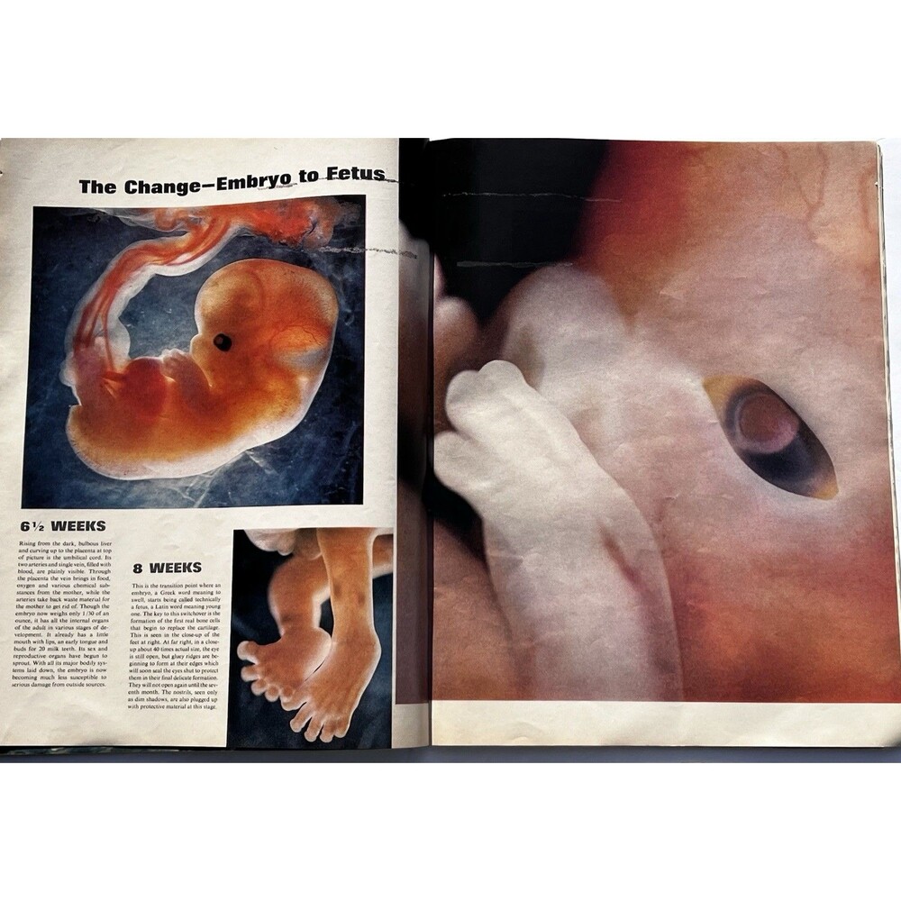 LIFE Magazine April 30, 1965 Drama Of Life Before Birth Issue - Picture 4 of 10